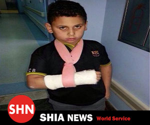 شکستن دست دانش آموز شیعه ده ساله توسط معلم وهابی اش در سعودی